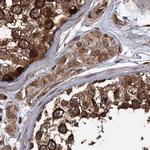 RPAP3 Antibody in Immunohistochemistry (IHC)