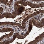 RPAP3 Antibody in Immunohistochemistry (IHC)