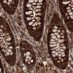 RPAP3 Antibody in Immunohistochemistry (IHC)