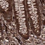 RPAP3 Antibody in Immunohistochemistry (IHC)