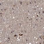 RPAP3 Antibody in Immunohistochemistry (IHC)