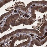 RPAP3 Antibody in Immunohistochemistry (IHC)
