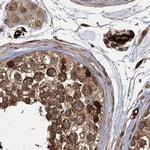RPAP3 Antibody in Immunohistochemistry (IHC)