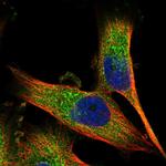 CALCOCO1 Polyclonal Antibody