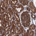 CALCOCO1 Antibody in Immunohistochemistry (Paraffin) (IHC (P))
