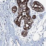 CALCOCO1 Antibody in Immunohistochemistry (Paraffin) (IHC (P))