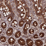DHX29 Antibody in Immunohistochemistry (Paraffin) (IHC (P))