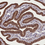 DHX29 Antibody in Immunohistochemistry (Paraffin) (IHC (P))
