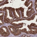 DHX29 Antibody in Immunohistochemistry (IHC)