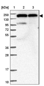 DHX29 Antibody in Western Blot (WB)