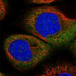 DHX29 Polyclonal Antibody