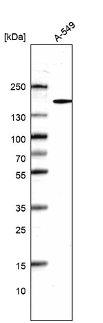 DHX29 Antibody in Western Blot (WB)