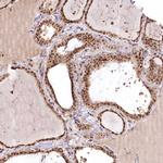 PYROXD1 Antibody in Immunohistochemistry (IHC)