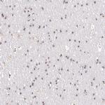 PYROXD1 Antibody in Immunohistochemistry (IHC)