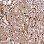 PYROXD1 Antibody in Immunohistochemistry (IHC)