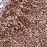 ST7 Antibody in Immunohistochemistry (Paraffin) (IHC (P))