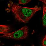 R3HDM2 Polyclonal Antibody