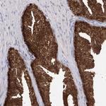 R3HDM2 Antibody in Immunohistochemistry (Paraffin) (IHC (P))