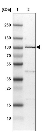 R3HDM2 Antibody in Western Blot (WB)