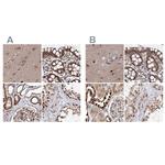 BUD13 Antibody in Immunohistochemistry (IHC)