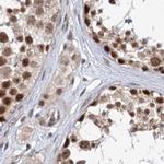 BUD13 Antibody in Immunohistochemistry (IHC)