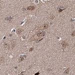 BUD13 Antibody in Immunohistochemistry (IHC)