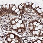 BUD13 Antibody in Immunohistochemistry (IHC)