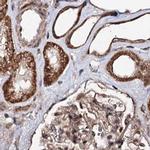 BUD13 Antibody in Immunohistochemistry (IHC)