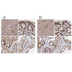 BUD13 Antibody in Immunohistochemistry (IHC)