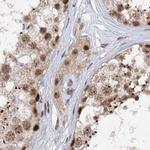 BUD13 Antibody in Immunohistochemistry (IHC)