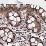BUD13 Antibody in Immunohistochemistry (IHC)