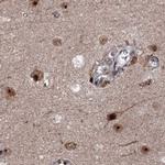BUD13 Antibody in Immunohistochemistry (IHC)