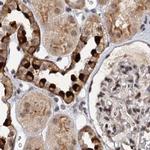 BUD13 Antibody in Immunohistochemistry (IHC)