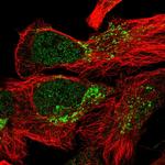 ZCCHC24 Polyclonal Antibody