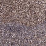 ZCCHC24 Antibody in Immunohistochemistry (Paraffin) (IHC (P))