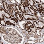ZCCHC24 Antibody in Immunohistochemistry (IHC)