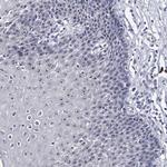 PCGF5 Antibody in Immunohistochemistry (Paraffin) (IHC (P))