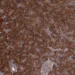 TBC1D9B Antibody in Immunohistochemistry (Paraffin) (IHC (P))
