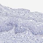 SLC3A1 Antibody in Immunohistochemistry (Paraffin) (IHC (P))