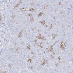 SLC3A1 Polyclonal Antibody
