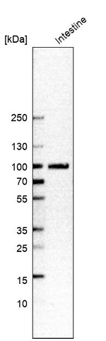 SLC3A1 Antibody in Western Blot (WB)