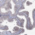 SEMA4G Antibody in Immunohistochemistry (Paraffin) (IHC (P))