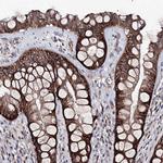 SEMA4G Antibody in Immunohistochemistry (Paraffin) (IHC (P))