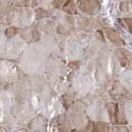 C5orf33 Polyclonal Antibody