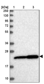 EXOSC1 Antibody in Western Blot (WB)