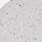 ARSI Polyclonal Antibody