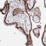 C11orf52 Antibody in Immunohistochemistry (Paraffin) (IHC (P))