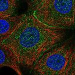 C11orf52 Polyclonal Antibody