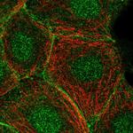 C11orf52 Polyclonal Antibody