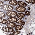 C11orf52 Antibody in Immunohistochemistry (Paraffin) (IHC (P))